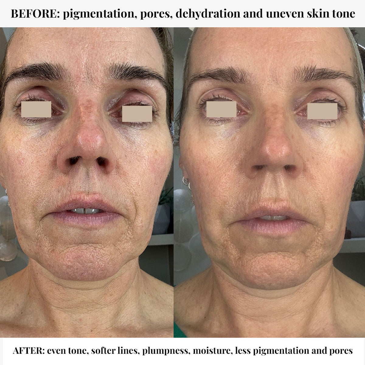 Book a Skin Consultation